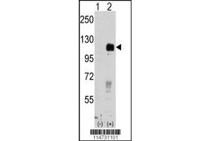 Western blot analysis of EphB4 using rabbit polyclonal EphB4 Antibody. (EPH Receptor B4 抗体)