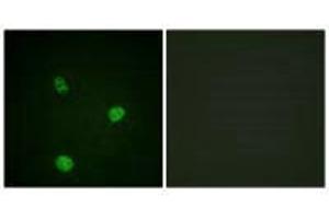 Immunofluorescence analysis of HeLa cells, using MITF (Ab-180/73) antibody. (MITF 抗体  (Ser73, Ser180))