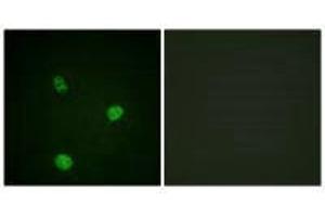 Immunofluorescence analysis of HeLa cells, using MITF (Ab-180/73) antibody.