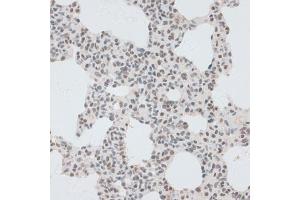Immunohistochemistry of paraffin-embedded rat brain using ZNF148 antibody (ABIN6130815, ABIN6150463, ABIN6150464 and ABIN6222770) at dilution of 1:100 (40x lens). (ZNF148 抗体  (AA 690-794))