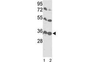 Western Blotting (WB) image for anti-Voltage-Dependent Anion Channel 1 (VDAC1) (AA 95-124) antibody (ABIN3029603)