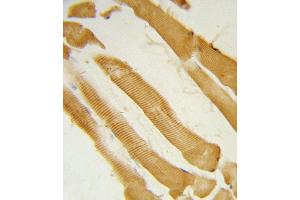 Formalin-fixed and paraffin-embedded human skeletal muscle reacted with ITPKC Antibody (N-term), which was peroxidase-conjugated to the secondary antibody, followed by DAB staining. (ITPKC 抗体  (N-Term))