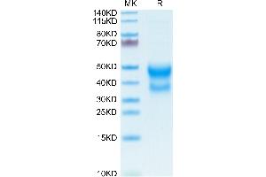 SDS-PAGE (SDS) image for CD300a (CD300A) (AA 28-185) protein (His tag) (ABIN7274285)