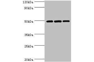 Western blot All lanes: m7GpppN-mRNA hydrolase antibody at 7 μg/mL Lane 1: Hela whole cell lysate Lane 2: Jurkat whole cell lysate Lane 3: 293T whole cell lysate Secondary Goat polyclonal to rabbit IgG at 1/10000 dilution Predicted band size: 49, 45 kDa Observed band size: 49 kDa (DCP2 抗体  (AA 1-240))