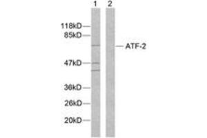 Western Blotting (WB) image for anti-Activating Transcription Factor 2 (ATF2) (AA 79-128) antibody (ABIN2888948) (ATF2 抗体  (AA 79-128))