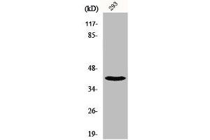 Western Blot analysis of 293 cells using NBPF1/9/10/12/14/15/16/20 Polyclonal Antibody (NBPF12/NBPF1/NBPF1/NBPF9/NBPF2/NBPF15/NBPF14 (C-Term) 抗体)