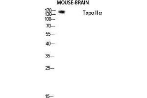 Western Blot (WB) analysis of Mouse Brain lysis using Topo IIalpha antibody. (Topo IIalpha (Tyr174) 抗体)