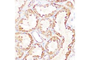 Immunohistochemistry of paraffin-embedded rat kidney using DLDH/DLD Rabbit mAb (ABIN7266766) at dilution of 1:100 (40x lens). (DLD 抗体)