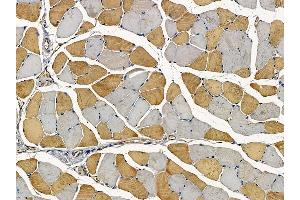 ABIN7094266 and ABIN7098313 at 1/100 staining mouse muscle tissue by IHC-P. (Golgin A3 抗体  (Internal Region))