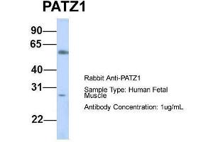 Host:  Rabbit  Target Name:  PATZ1  Sample Type:  Human Fetal Muscle  Antibody Dilution:  1. (PATZ1 抗体  (N-Term))