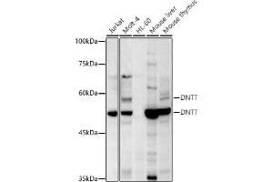 Western blot analysis of extracts of various cell lines, using TdT antibody (ABIN6130878, ABIN6139759, ABIN6139760 and ABIN6221856) at 1:500 dilution. (TdT 抗体  (AA 260-509))