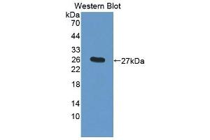 Detection of Recombinant CTSF, Mouse using Polyclonal Antibody to Cathepsin F (CTSF) (Cathepsin F 抗体  (AA 249-462))