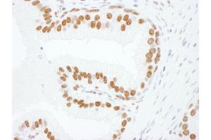 Immunohistochemistry (IHC) image for anti-Heterogeneous Nuclear Ribonucleoprotein L (HNRNPL) (C-Term) antibody (ABIN7795592)