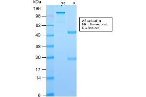 SDS-PAGE Analysis Purified DOG-1 Rabbit Recombinant Monoclonal Antibody (DG1/2564R). (Recombinant ANO1 抗体  (AA 2-101))