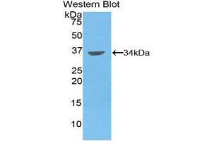 Western Blotting (WB) image for anti-Matrix Metallopeptidase 7 (Matrilysin, Uterine) (MMP7) (AA 1-267) antibody (ABIN1859858) (MMP7 抗体  (AA 1-267))