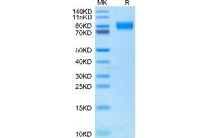 Human IL-2 R gamma on Tris-Bis PAGE under reduced condition. (IL2RG Protein (AA 23-254) (Fc Tag))