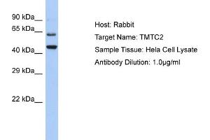Host: Rabbit Target Name: TMTC2 Sample Type: Hela Whole cell lysates Antibody Dilution: 1. (TMTC2 抗体  (C-Term))
