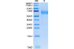 SDS-PAGE (SDS) image for Interleukin 23 Receptor (IL23R) (AA 24-354) protein (His tag) (ABIN7275011)