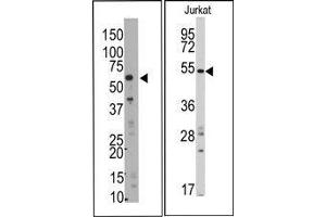 Image no. 1 for anti-SMYD Family Member 5 (SMYD5) (C-Term) antibody (ABIN358724) (SMYD5 抗体  (C-Term))