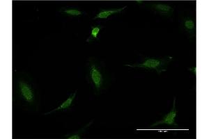 Immunofluorescence of monoclonal antibody to CDR2 on HeLa cell. (CDR2 抗体  (AA 296-404))