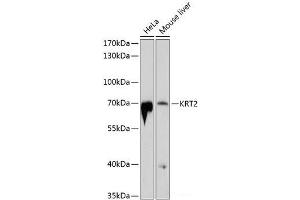 Western blot analysis of extracts of various cell lines using KRT2 Polyclonal Antibody at dilution of 1:1000. (Keratin 2 抗体)