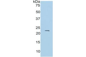 WB of Protein Standard: different control antibodies  against Highly purified E. (PROS1 ELISA 试剂盒)