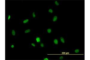 Immunofluorescence of monoclonal antibody to HDAC1 on HeLa cell. (HDAC1 抗体  (AA 1-482))