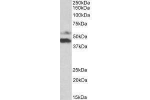 ABIN5539924 (1µg/ml) staining of Human Colorectal Cancer lysate (35µg protein in RIPA buffer). (PYROXD1 抗体  (N-Term))