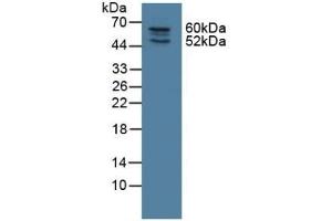 Detection of NOSTRIN in Rat Lung Tissue using Polyclonal Antibody to Nitric Oxide Synthase Trafficker (NOSTRIN) (NOSTRIN 抗体  (AA 1-245))
