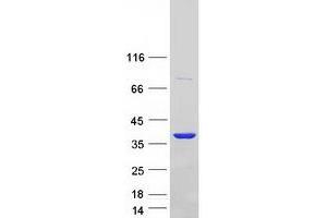 Western Blotting (WB) image for Annexin A2 (ANXA2) (Transcript Variant 3) protein (Myc-DYKDDDDK Tag) (ABIN2714736)