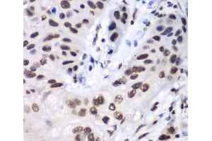 Immunohistochemistry (Paraffin-embedded Sections) (IHC (p)) image for anti-Ligase III, DNA, ATP-Dependent (LIG3) antibody (ABIN7257088)