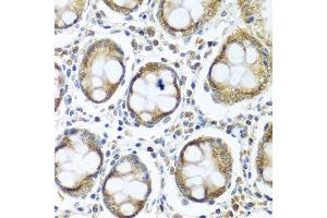 Immunohistochemistry of paraffin-embedded human colon using IFI44 antibody at dilution of 1:100 (40x lens). (IFI44 抗体)