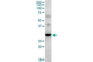 FAIM2 polyclonal antibody (A01), Lot # 051122JC01. (FAIM2 抗体  (AA 1-316))