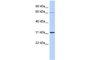WB Suggested Anti-ZNF691 Antibody Titration:  0. (ZNF691 抗体  (Middle Region))