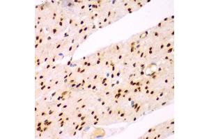 Immunohistochemistry of paraffin-embedded human colon using TEAD3 antibody (ABIN5975292) at dilution of 1/100 (40x lens). (TEAD3 抗体)