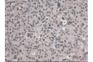Immunohistochemical staining of paraffin-embedded colon using anti-Notch1 (ABIN2452671) mouse monoclonal antibody. (Notch1 抗体  (AA 2300-2556))