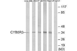 Immunohistochemistry analysis of paraffin-embedded human placenta tissue using CYB5R3 antibody. (CYB5R3 抗体  (Internal Region))