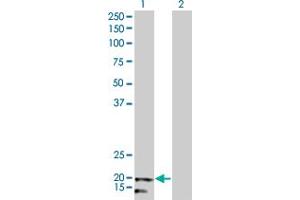 Western Blot analysis of NDUFB5 expression in transfected 293T cell line by NDUFB5 monoclonal antibody (M01), clone 5G5. (NDUFB5 抗体  (AA 95-189))