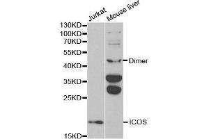 Western blot analysis of extracts of various cell lines, using ICOS antibody. (ICOS 抗体  (AA 21-140))