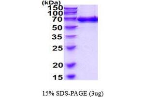 SDS-PAGE (SDS) image for Endoglin (ENG) (AA 27-581) protein (His tag) (ABIN6387814) (Endoglin Protein (ENG) (AA 27-581) (His tag))