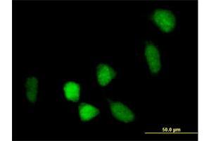 Immunofluorescence of purified MaxPab antibody to BCOR on HeLa cell. (BCOR 抗体  (AA 1-1004))