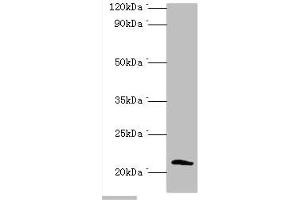 Western blot All lanes: Protein SSX2 antibody at 2 μg/mL + MDA-MB-231 whole cell lysate Secondary Goat polyclonal to rabbit IgG at 1/10000 dilution Predicted band size: 22, 26 kDa Observed band size: 22 kDa (SSX2 抗体  (AA 1-188))