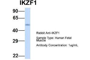 Host:  Rabbit  Target Name:  IKZF1  Sample Type:  Human Fetal Muscle  Antibody Dilution:  1. (IKZF1 抗体  (Middle Region))