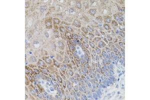 Immunohistochemistry of paraffin-embedded human esophagus using SM antibody (ABIN1682808, ABIN5663732, ABIN5663734 and ABIN6213914) (40x lens). (SMAD5 抗体  (AA 140-240))
