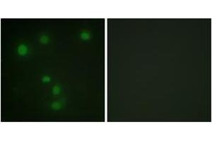Immunofluorescence analysis of HuvEc cells, using Retinoblastoma (Ab-826) Antibody.