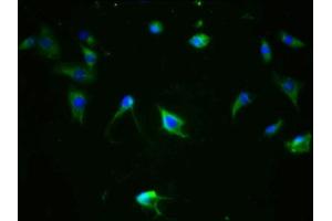 Immunofluorescence staining of SH-SY5Y cells with ABIN7127710 at 1:100,counter-stained with DAPI. (Recombinant MAPT 抗体  (pSer324))
