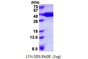 Image no. 1 for Prefoldin Subunit 3 (PFDN3) protein (His tag) (ABIN1098492) (VBP1 Protein (His tag))