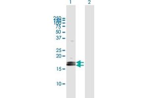 Western Blot analysis of LOC124220 expression in transfected 293T cell line by LOC124220 MaxPab polyclonal antibody. (ZG16B 抗体  (AA 1-172))