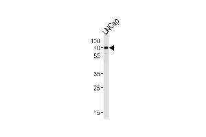 Western Blotting (WB) image for anti-Cytochrome P450, Family 51, Subfamily A, Polypeptide 1 (CYP51A1) (AA 250-279) antibody (ABIN652820)