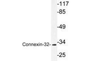 Western blot analysis of Connexin-32 antibody in extracts from LOVO cells. (GJB1 抗体)